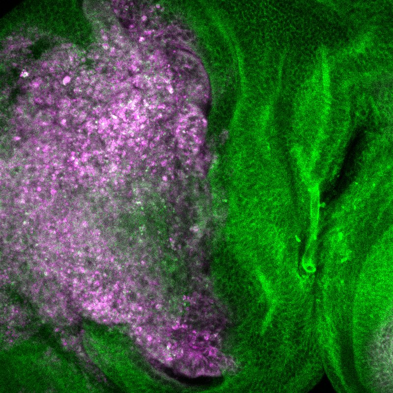 fluorescence microscopy picture