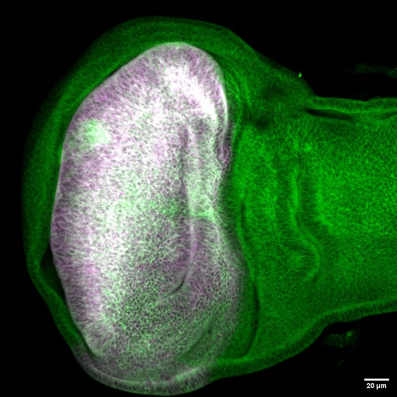 fluorescence microscopy picture
